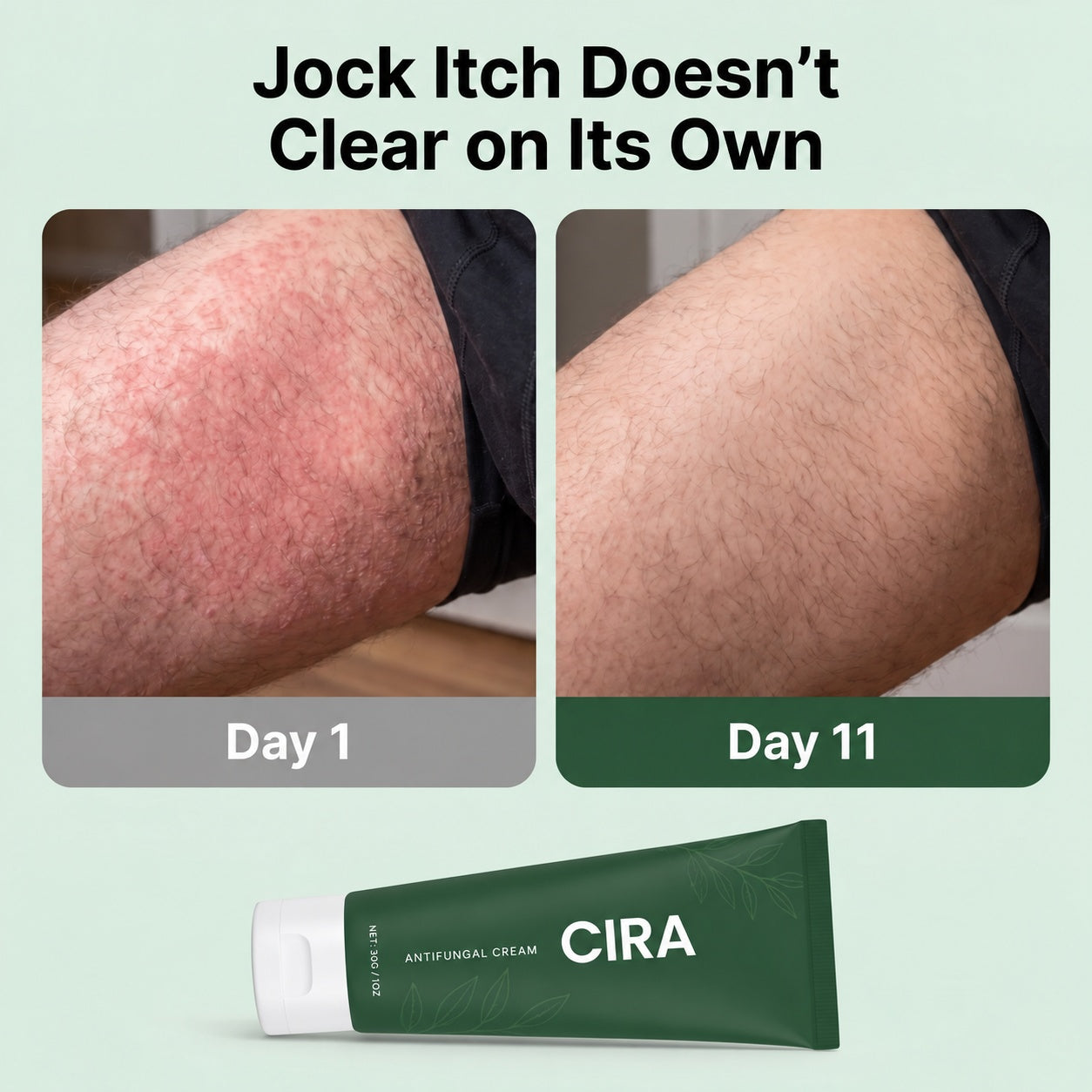 Cira - Antifungal Barrier Cream