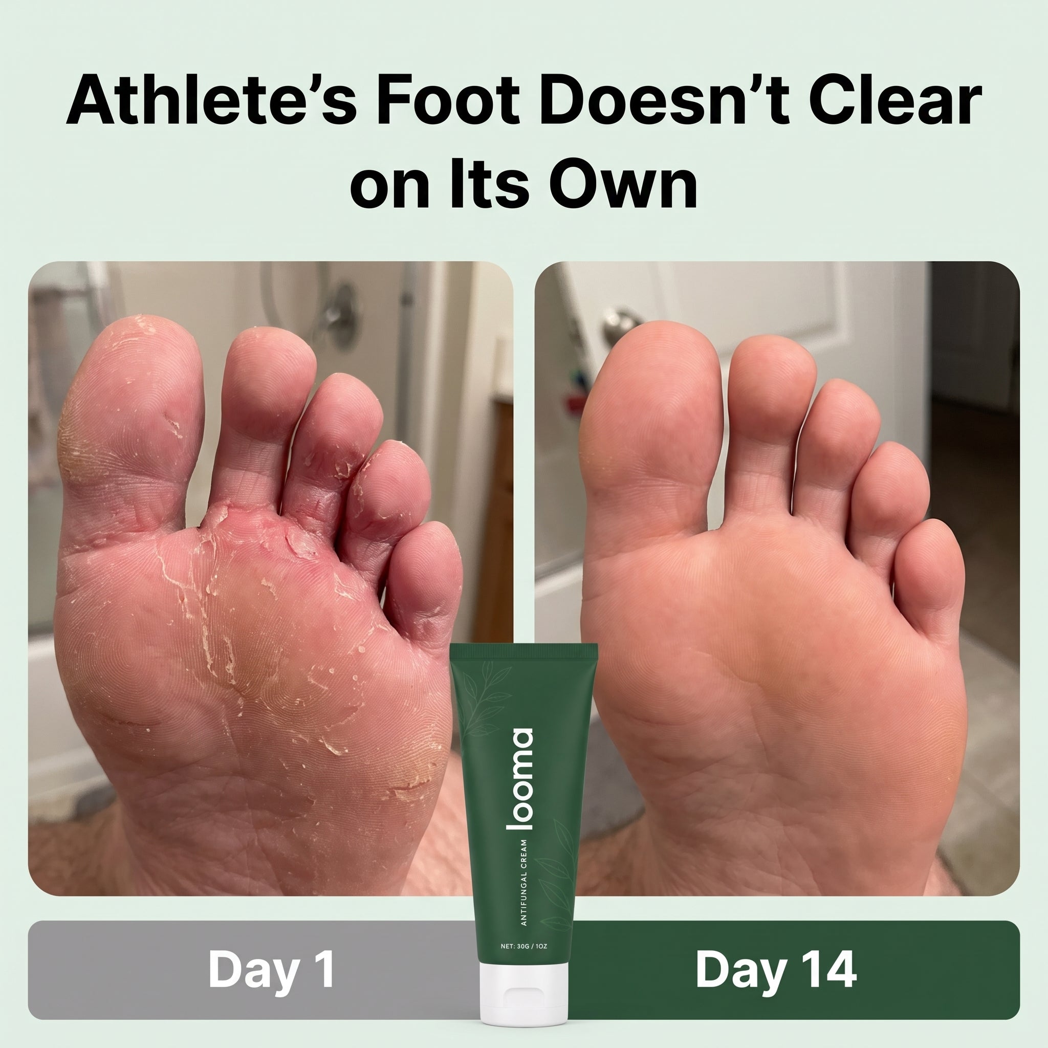 Cira - Antifungal Barrier Cream