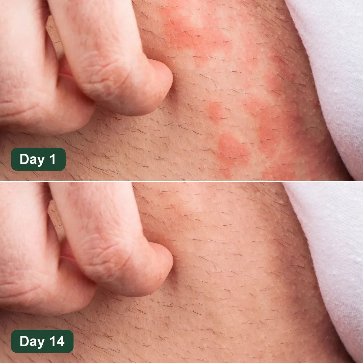 Cira - Antifungal Barrier Cream