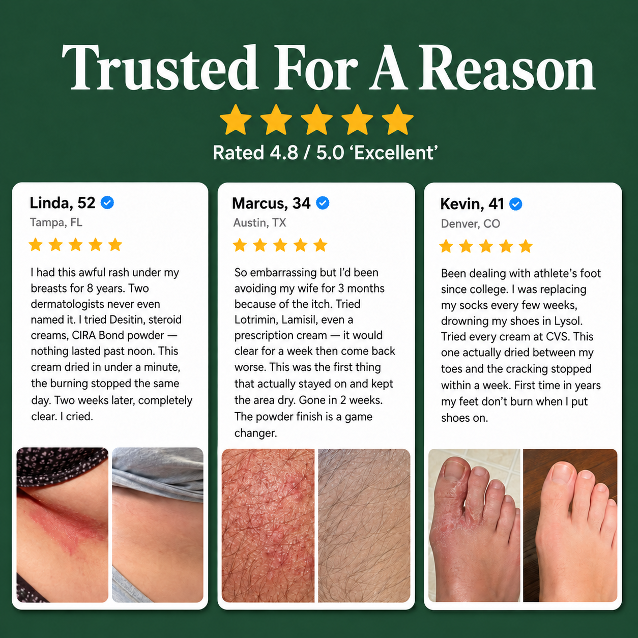 Cira - Antifungal Barrier Cream